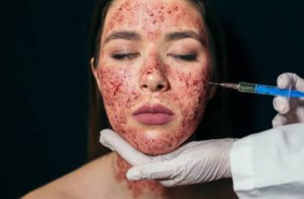 Best Dermatologist for Women for Vampire Facial for Skin Texture Problem
