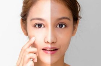 Best Aftercare Routine for Women After Skin Whitening Treatment Problem