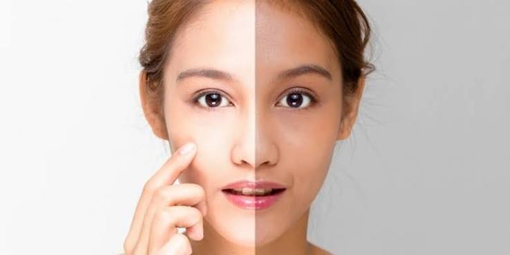 Best Aftercare Routine for Women After Skin Whitening Treatment Problem