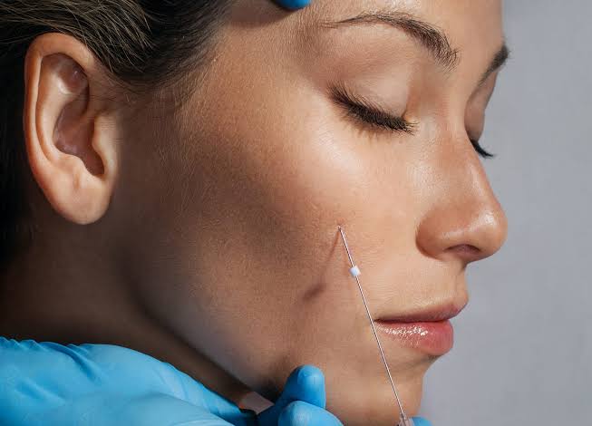 Best Aftercare Routine for Women After Thread Lift Problem