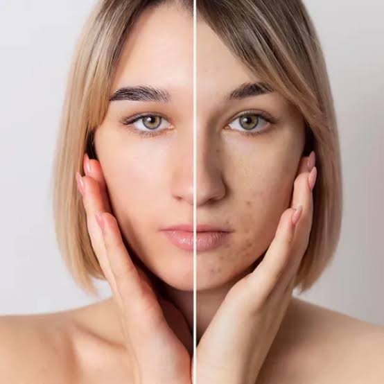 Best Skin Clinic for Pigmentation Problem