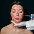 Best Treatment for Adults for Laser Toning for Uneven Skin Tone Problem