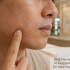 Best Skin Specialist Near Me in Gurgaon for Melasma Problem