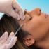 Best Skin Recovery Tips After Hydrafacial Treatment Problem