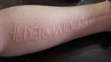 Best Skin Care for Adults for Dermatographia Problem: A Gentle Guide to Calm Your Skin