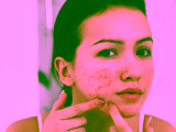 Dealing with PCOS Skin Issues? You Are Not Alone